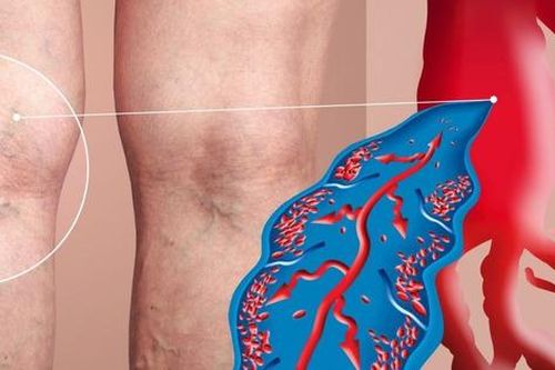 Các thuốc điều trị huyết khối tĩnh mạch sâu