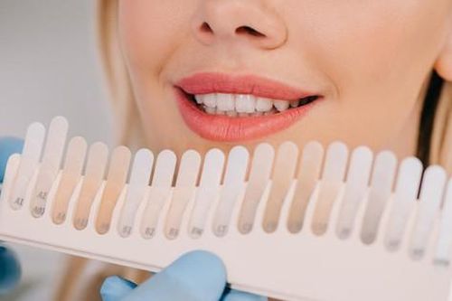 9 cách để làm trắng răng bị ố vàng