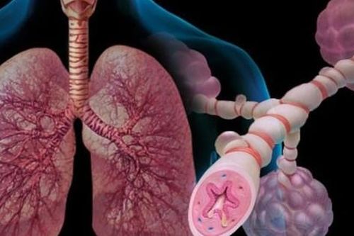 Dự phòng tái phát bệnh hen phế quản vào mùa lạnh