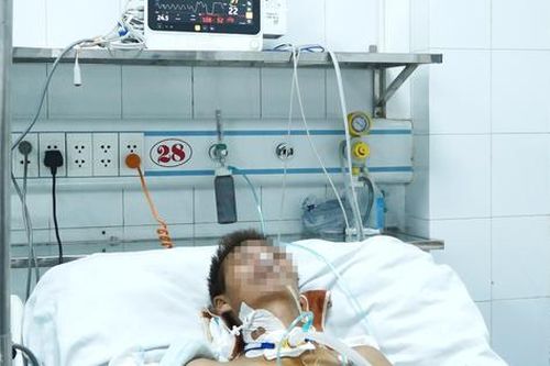 Truyền hơn 7 lít máu cứu bệnh nhân nguy kịch do ngã từ trên cao