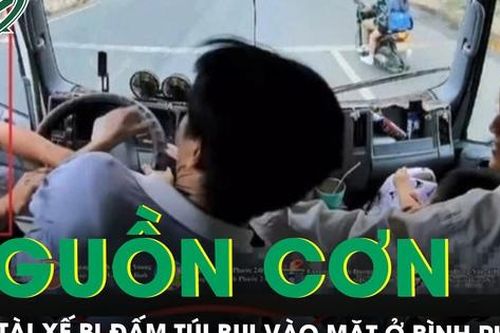 Nam tài xế xe tải bị đấm túi bụi vào mặt ở Bình Phước đau đớn kể lại nguồn cơn