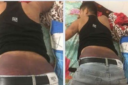 Nạn nhân bị tra tấn, chích điện mỗi ngày để đòi tiền chuộc