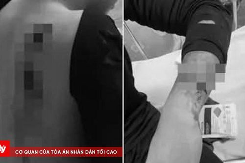 Nam sinh lớp 10 bị chém đứt gân tay trên đường từ sân bóng về nhà