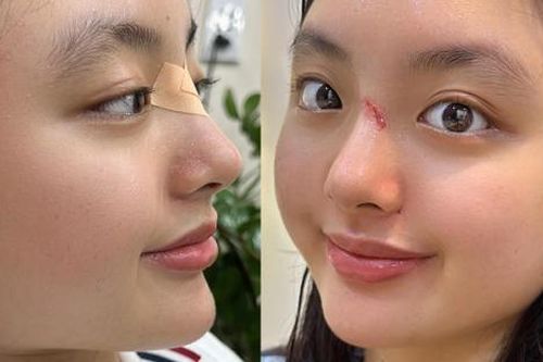 Ái nữ nhà Thúy Hạnh gặp sự cố