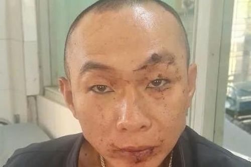 Bắt nhóm đối tượng sử dụng ma túy, dùng súng chống trả công an