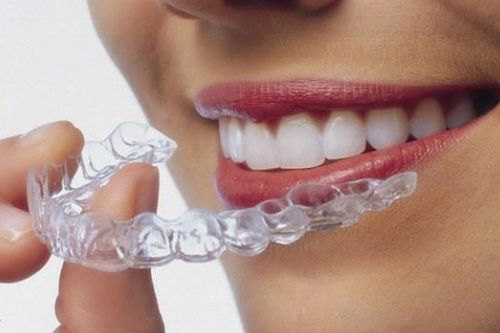 Giá niềng răng với trường hợp lựa chọn niềng mắc cài trong suốt?