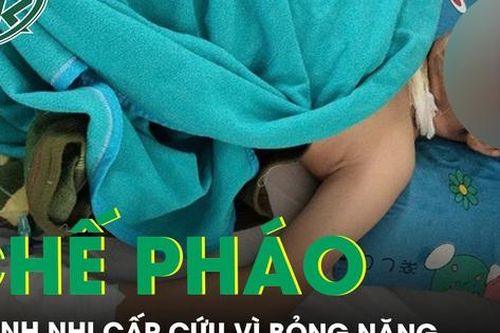Tự mua thuốc nổ trên mạng về chế pháo, 3 bệnh nhi bỏng nặng