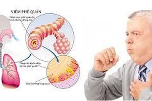 Khó thở, tức ngực, ho khan buổi sáng, có phải là dấu hiệu của hen suyễn?