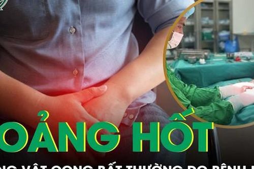 Hoảng hốt vì 'của quý' cong bất thường, đi khám phát hiện bệnh khó nói