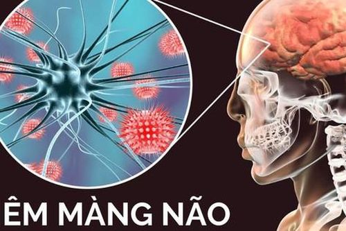 Bài tập nào tốt cho người viêm não Nhật Bản?