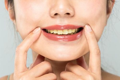 Có nên tẩy trắng răng bằng chanh?