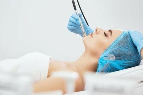 Những điều cần biết trước khi bắt đầu lăn kim tại nhà