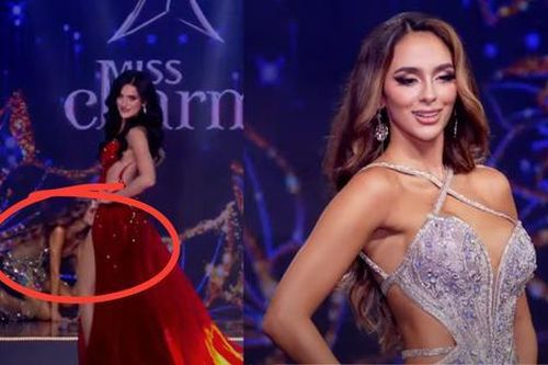 Thí sinh Hoa hậu bị té trước lúc trình diễn trang phục dạ hội