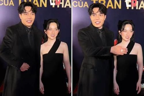 Em vợ Lê Dương Bảo Lâm mặt biến dạng do 'dao kéo' quá đà?