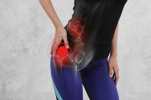 Cẩn thận với 13 nguyên nhân gây đau hông khi đi bộ