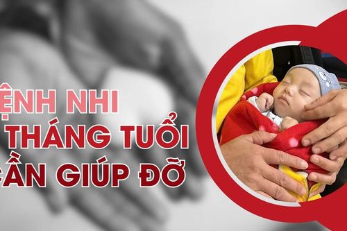Bệnh nhi 3 tháng tuổi cần giúp đỡ