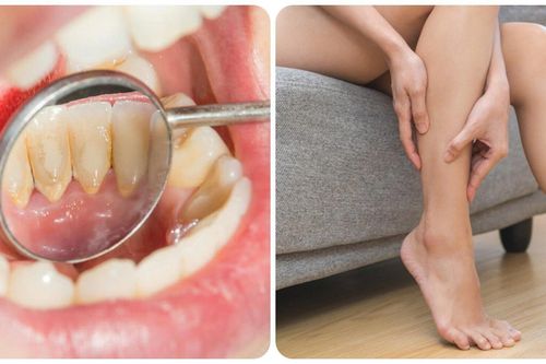 Thiếu canxi có tác hại gì?