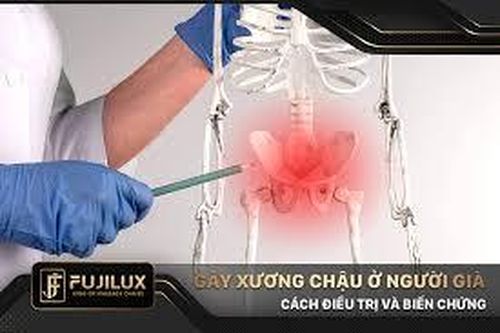Phương pháp điều trị gãy xương nào phù hợp với người lớn tuổi?