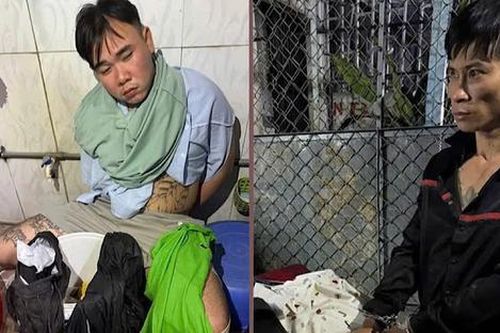 Bắt hai kẻ cướp giật túi xách làm người phụ nữ chấn thương sọ não