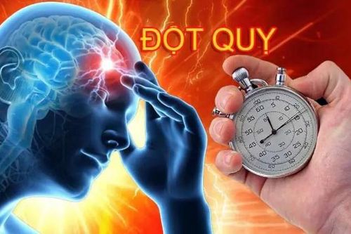 Thời điểm dễ gây đột quỵ trong mùa lạnh