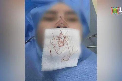 Hiểm họa từ các cơ sở thẩm mỹ không uy tín