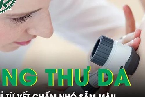 Bất ngờ phát hiện ung thư tế bào vảy chỉ từ vết chấm nhỏ sẫm màu