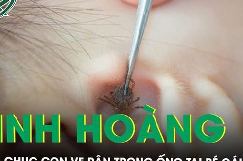 Kinh hoàng hàng chục con ve rận trong ống tai bé gái 6 tuổi