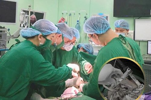 Bệnh viện Đa khoa TP Vinh: Cứu sống bệnh nhân ngừng tim ngoại viện do vết thương thấu ngực