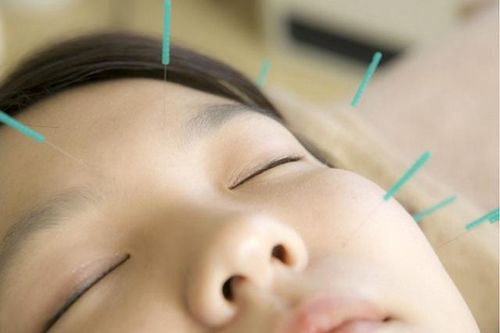 Thuốc và các phương pháp điều trị liệt mặt