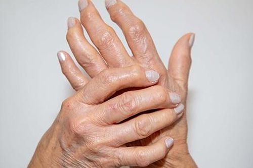 Những người có nguy cơ cao mắc bệnh viêm khớp dạng thấp