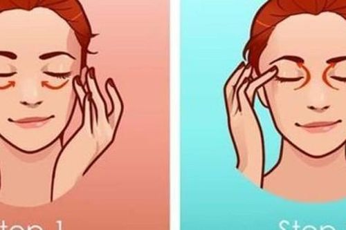 Bài tập tốt cho người loạn thị