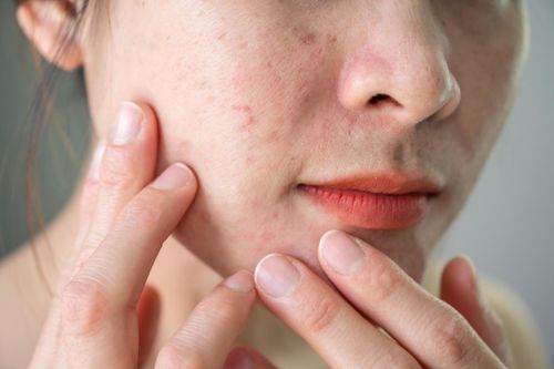 Dấu hiệu quen thuộc giúp người phụ nữ phát hiện ung thư