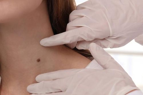 Người phụ nữ mắc 3 bệnh ung thư, bác sĩ cảnh báo dấu hiệu dễ bỏ qua