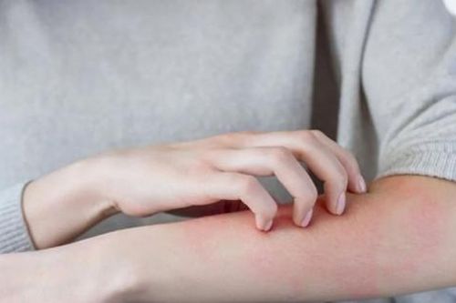Vì sao bị ngứa da vào mùa đông, xử lý thế nào?