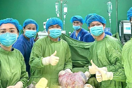 Phẫu thuật thành công cho một phụ nữ Campuchia có khối u gần 7 kg