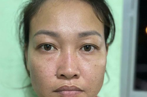 Bắt khẩn cấp người phụ nữ đánh nhân viên gác chắn tàu gãy xương mũi
