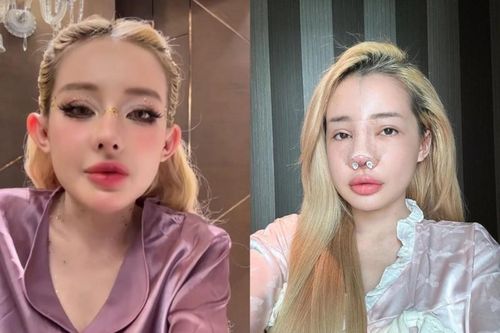 Ngân 98 tiết lộ phải nhập viện... do nhiễm trùng nặng