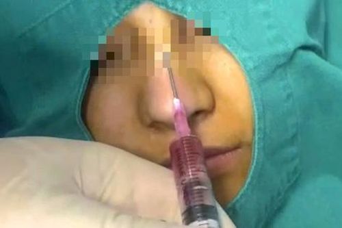 Làm đẹp cấp tốc cuối năm, coi chừng 'mất Tết'