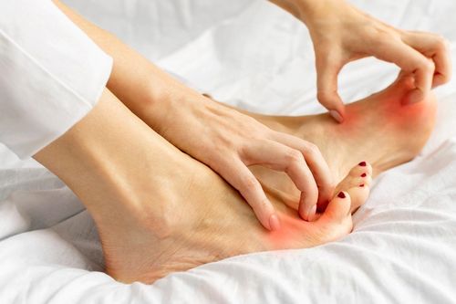 Một dấu hiệu điển hình của bệnh tiểu đường