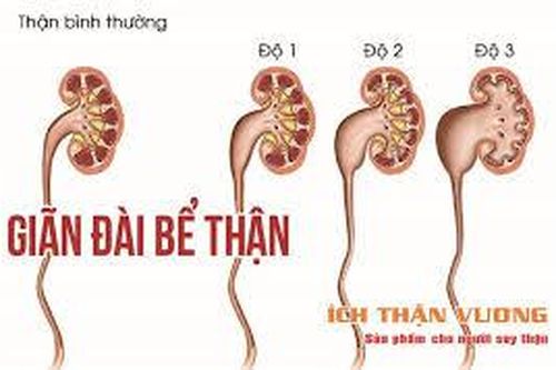 Giãn bể thận ở trẻ em có nguy hiểm không?
