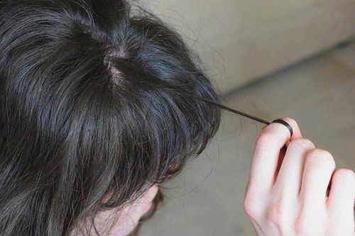 Cảnh báo hội chứng trẻ nhỏ 'nghiện' ăn tóc