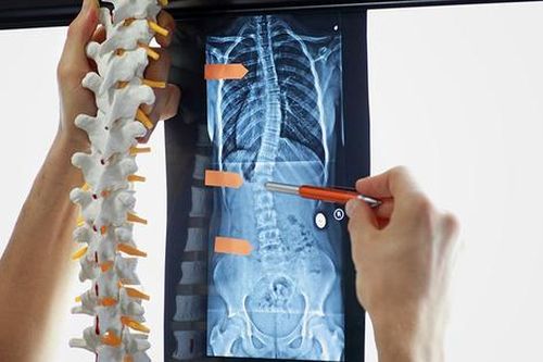 Nên làm gì khi bị đau cột sống thắt lưng?