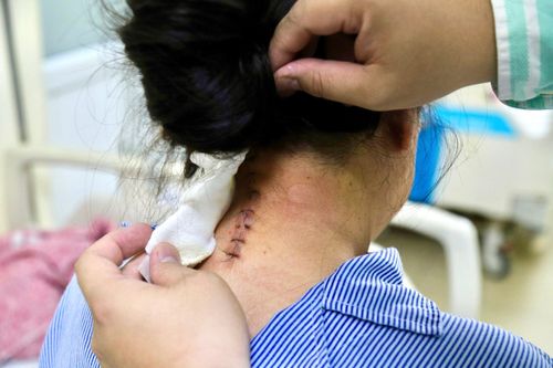 Đau cổ, tê bì một năm không khỏi, người phụ nữ phát hiện bệnh hiếm