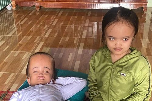 Một gia đình có 2 con mắc bệnh não úng thủy