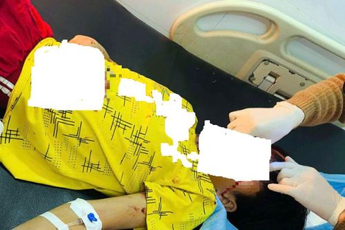 Nam sinh lớp 8 dập nát bàn tay vì điện thoại phát nổ khi đang sạc