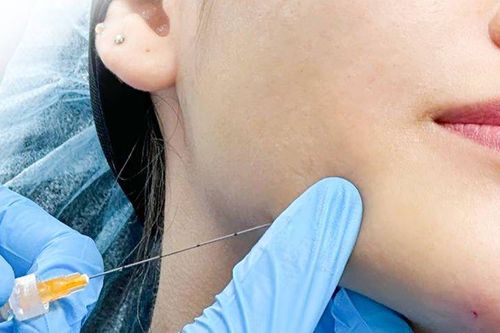 Dịch vụ trẻ hóa da không đau hút khách cuối năm
