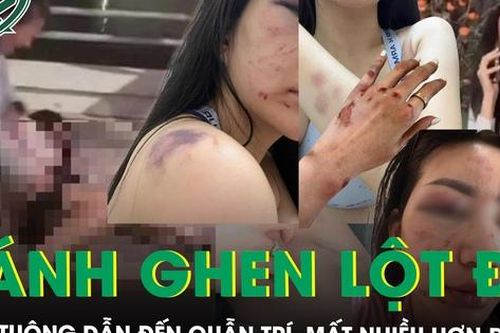 Vụ cô gái bị đánh ghen, lột đồ ở Cần Thơ: Ghen tuông dẫn đến quẫn trí, mất nhiều hơn được