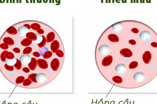 Tay chân lạnh cảnh báo điều gì?