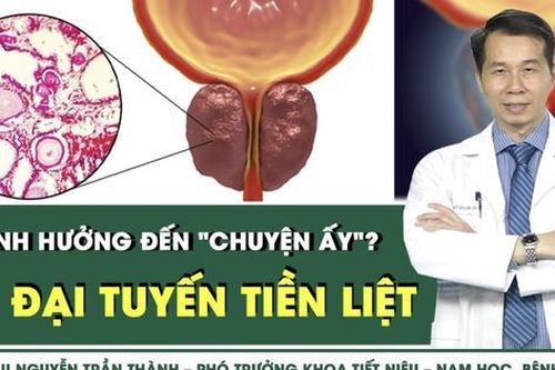 Phì đại tuyến tiền liệt có ảnh hưởng 'chuyện ấy'?