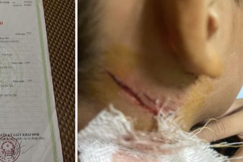Diễn biến mới vụ bé trai 11 tuổi nghi bị hành hạ khi câu cá ở ao hàng xóm